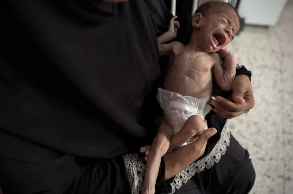 Στη Γάζα υποσιτίζονται και τα βρέφη